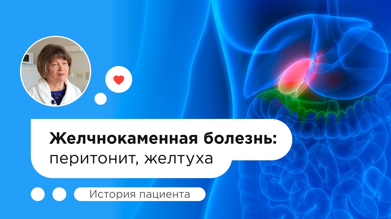Как мне удалили желчный пузырь бесплатно по полису ОМС