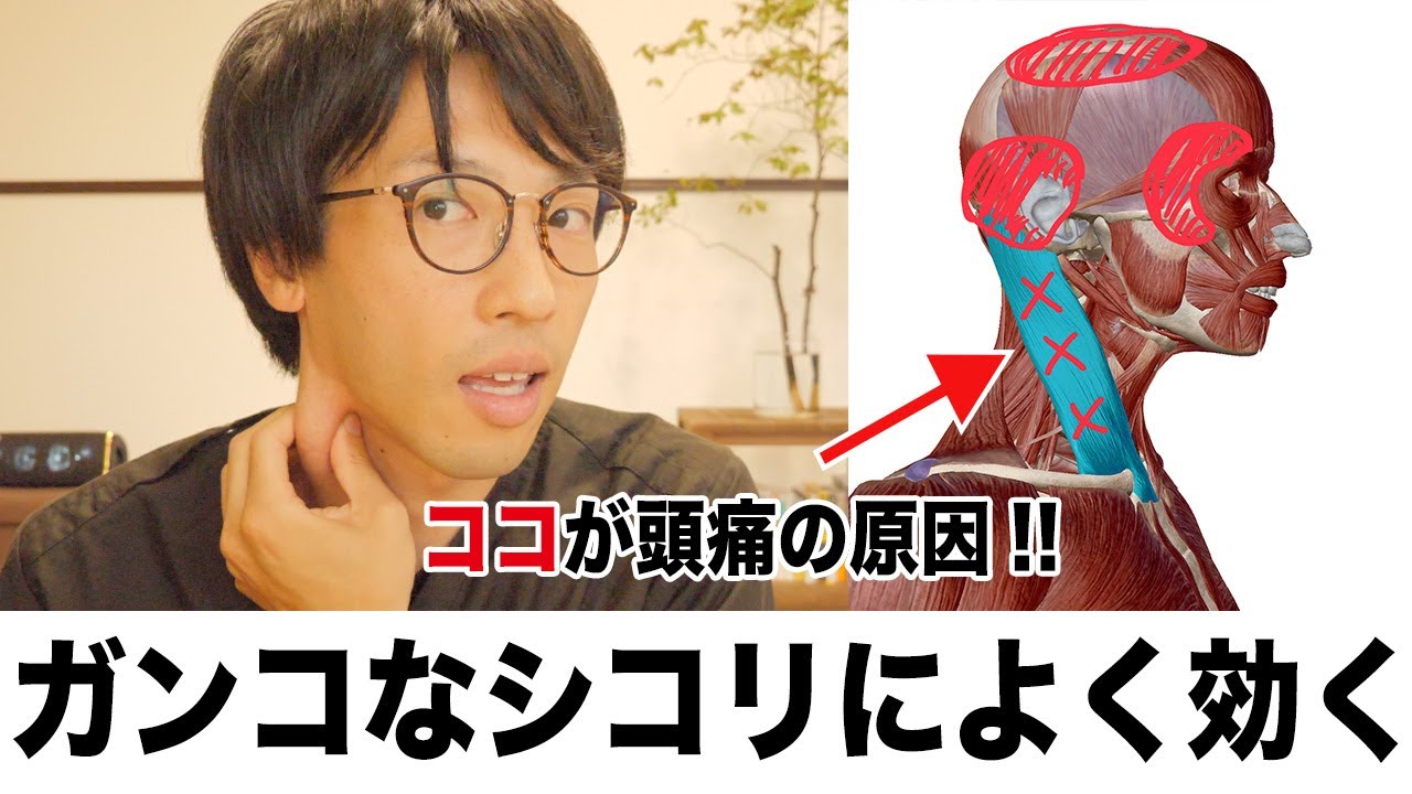 薬で治らない頭痛を改善するセルフマッサージ！胸鎖乳突筋筋膜リリース編【目の奥、おでこ、頭頂部が痛い人へ】