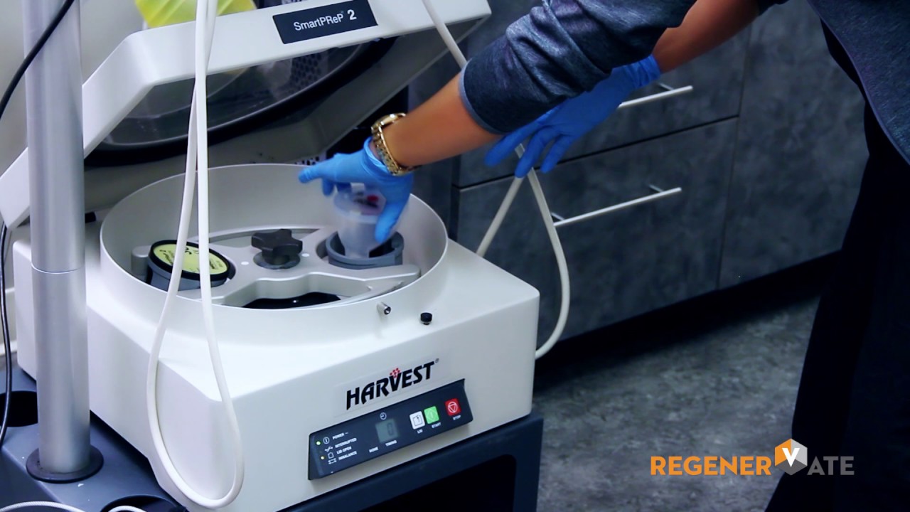 PRP (Platelet Rich Plasma) Injections