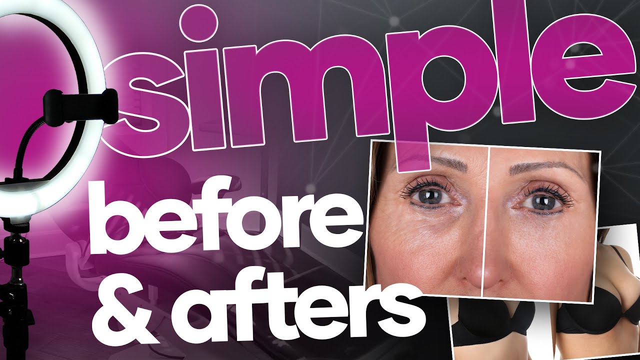 DIY Simple Before and After Photo Studio for Your Medical Practice
