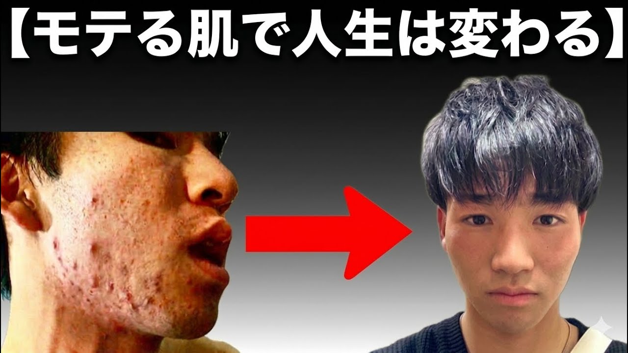 モテる肌を手に入れて人生が変わったメリット３選