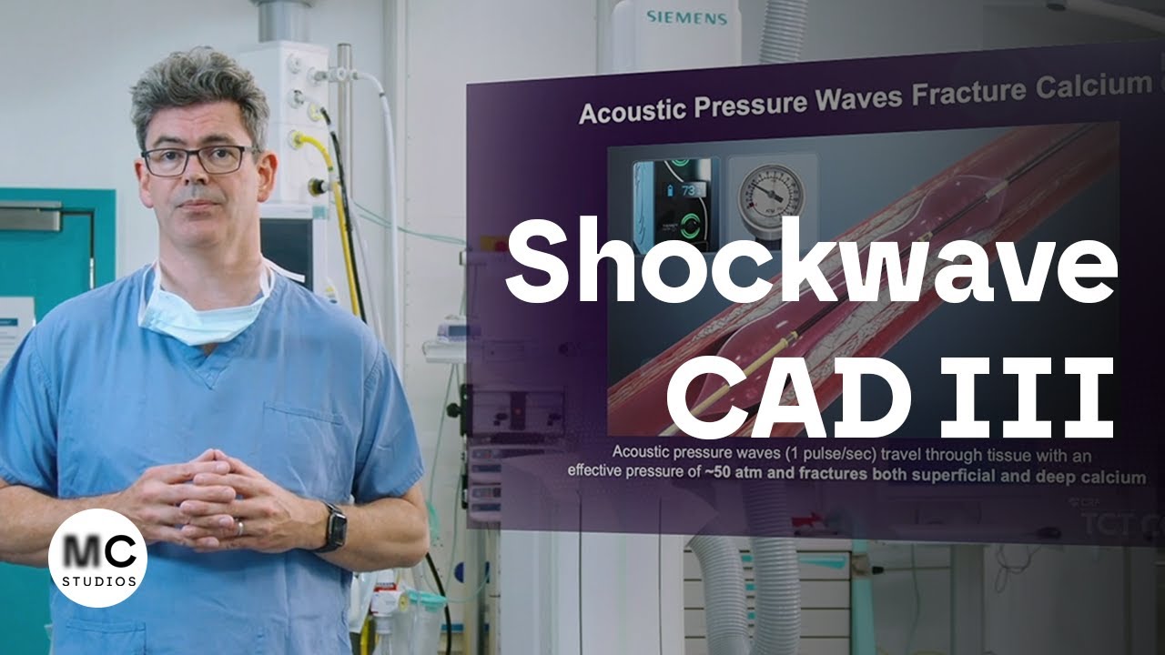 Shockwave. CAD III Results.