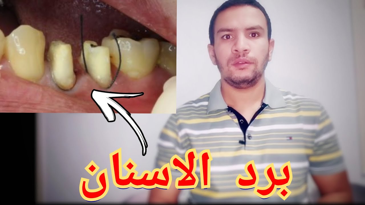 تصغير و برد الاسنان لعمل التركيبات الثابته | ليه تبوظ اسنانك و تصغرها