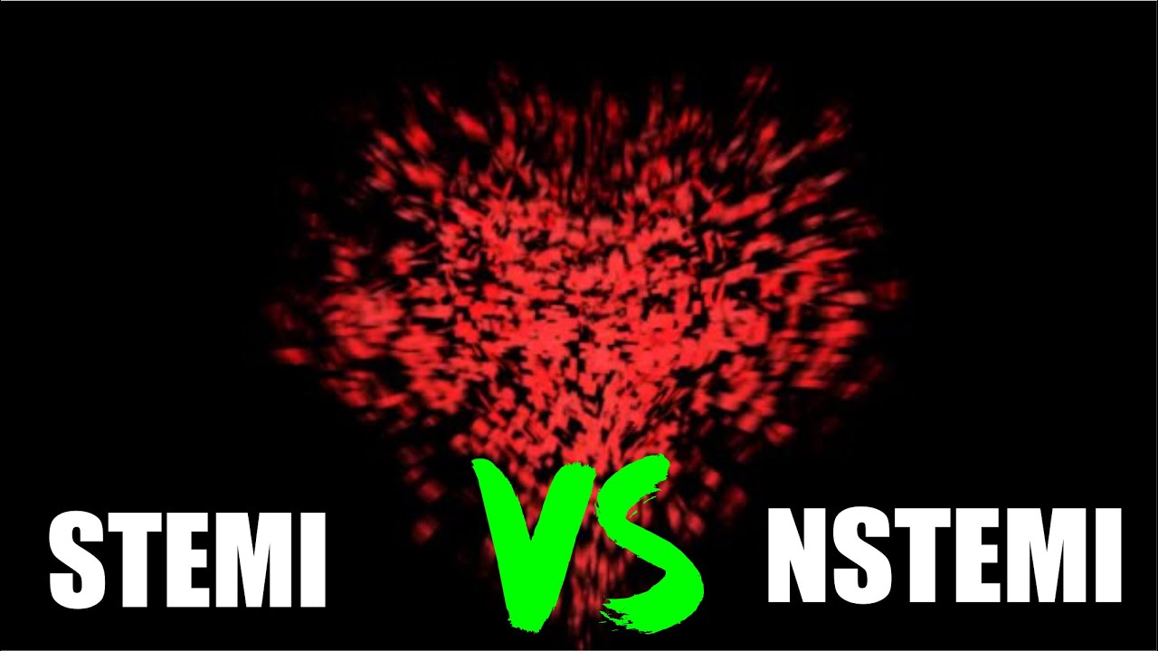 ИМпST против ИМбпST