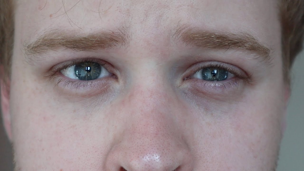 Embracing My Blindness