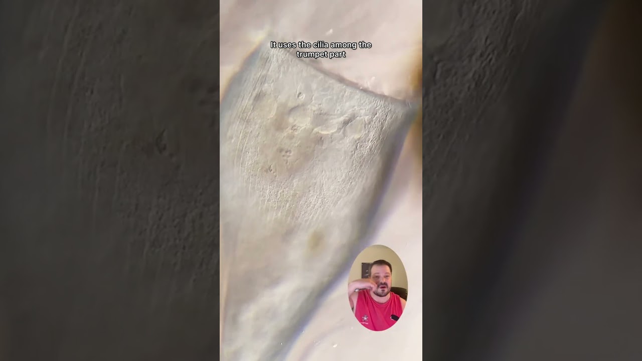 Stentor coeruleus in 4 minutes