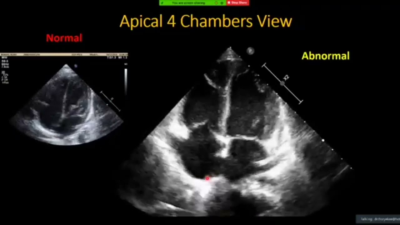 Echocardiography case studies edited by Dr Huzaimah ( English)