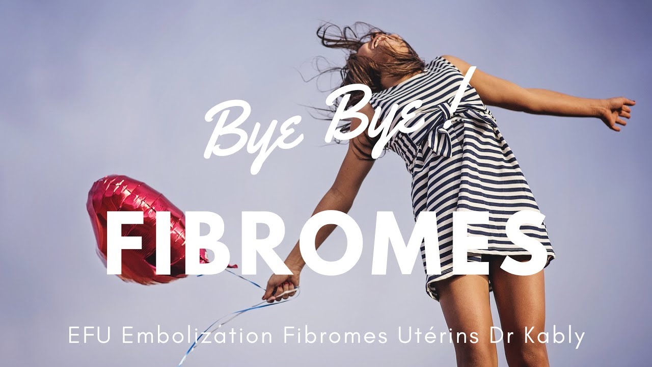 🚺   Embolisation Fibrome Utérin Étude d'un cas