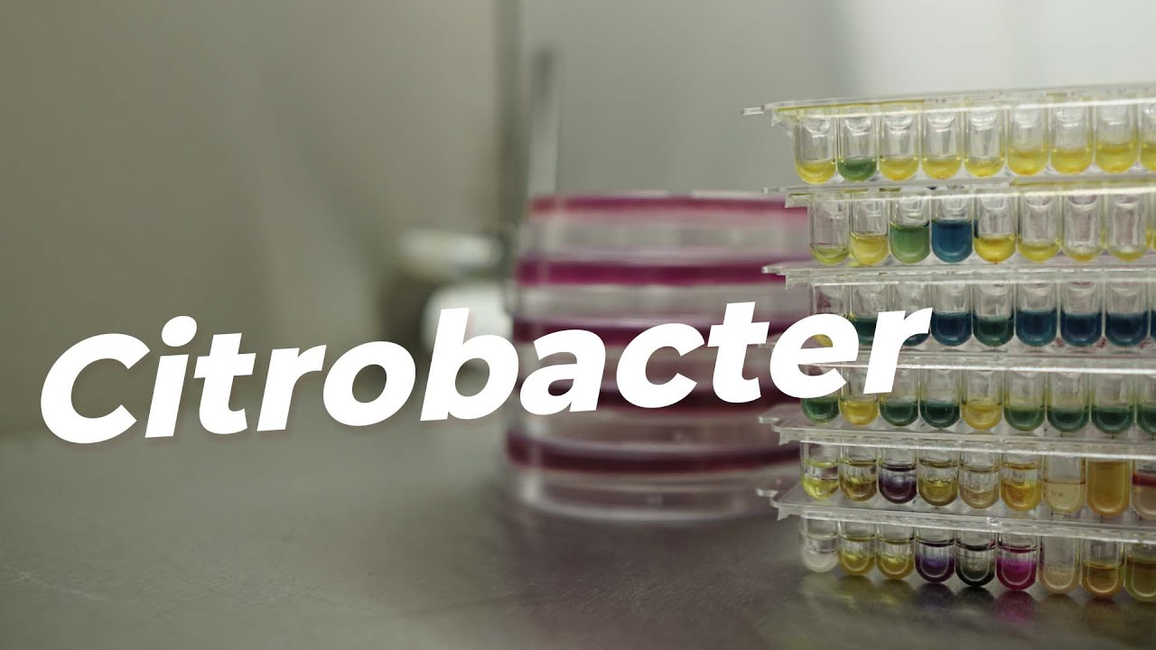 Como identificar Citrobacter no laboratório de Bacteriologia?