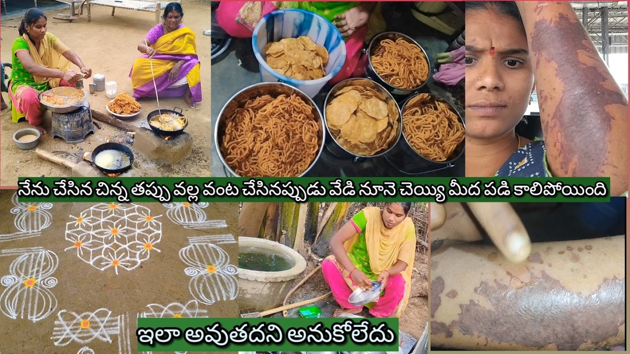 నేను చేసిన చిన్న తప్పు వల్ల వంట చేసినప్పుడు చెయ్యి మొత్తం కాలిపోయింది #villagestylecooking #trending