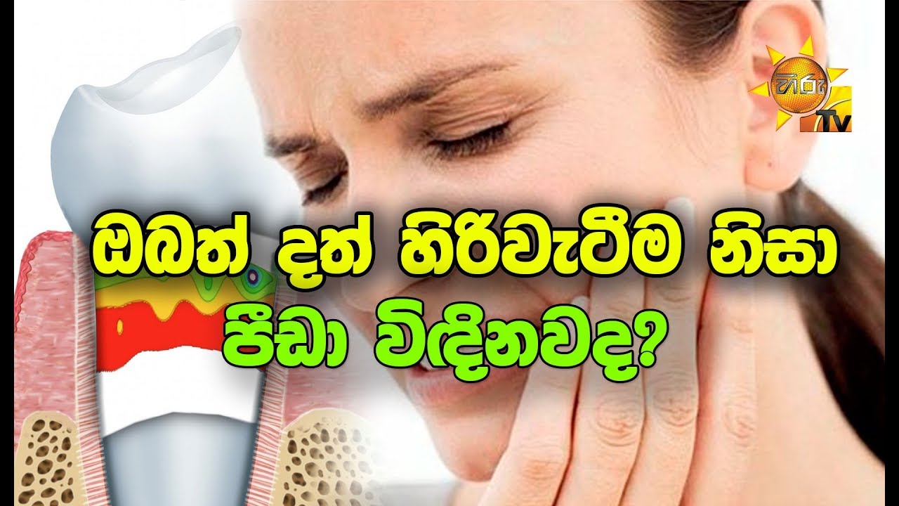 ඔබත් දත් හිරිවැටීම නිසා පීඩා විඳිනවද?