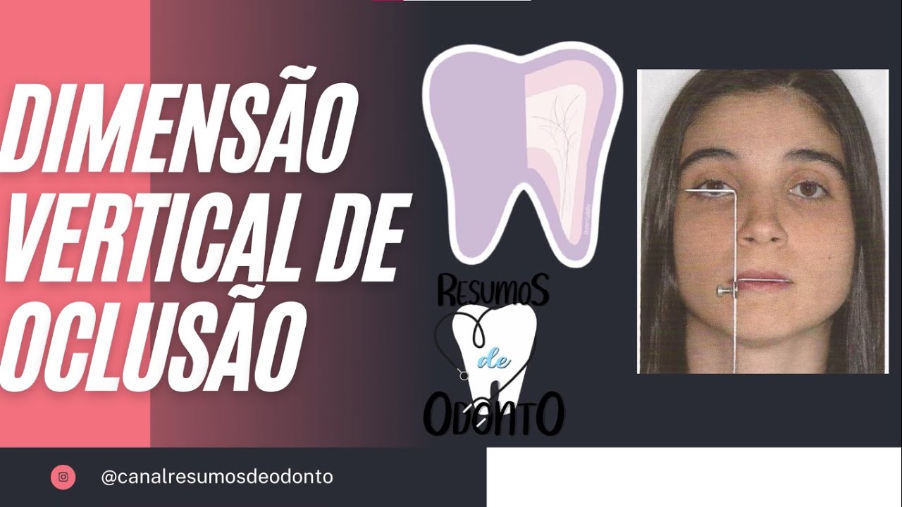 DIMENSÃO VERTICAL DE OCLUSÃO | RESUMOS DE ODONTO