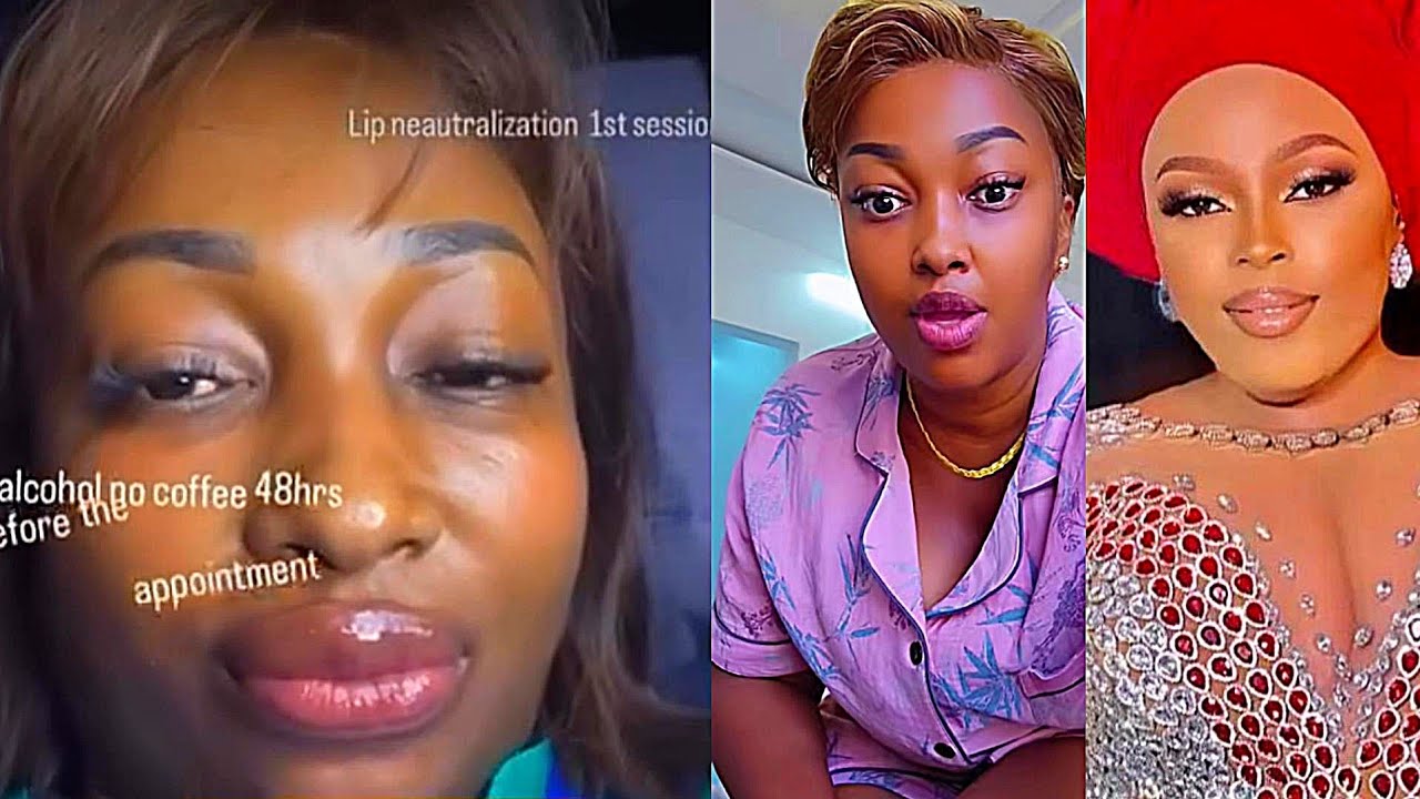 VIDEO AUNT EZEKIEL KAFANYA SURGERY YA MDOMO/ MAIMATHA KAMPIGIA SIMU KUELEZEA ILIVYOKUWA