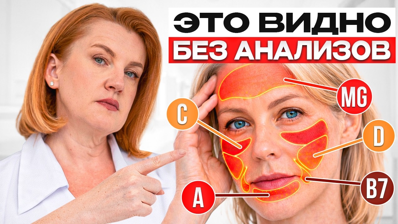 Врач объясняет как УВИДЕТЬ дефициты витаминов БЕЗ АНАЛИЗОВ! Проверьте себя