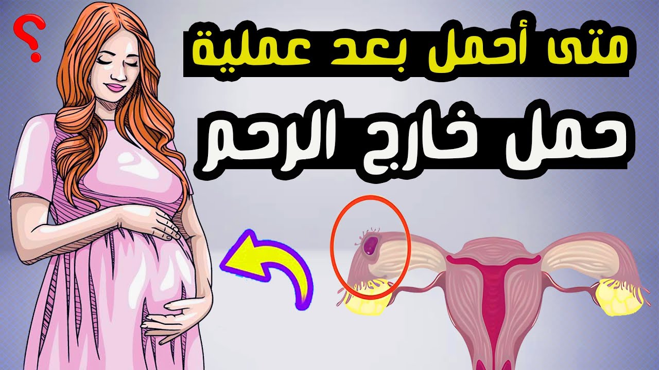 متى أحمل بعد عملية حمل خارج الرحم