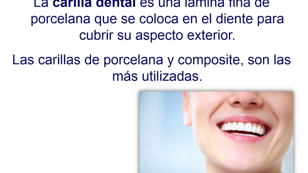 Tipos de carillas dentales