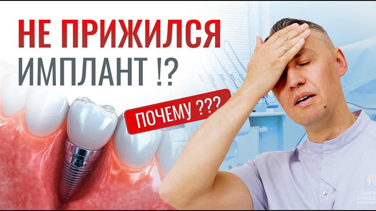 ПОЧЕМУ ОТТОРГАЮТСЯ ИМПЛАНТЫ?