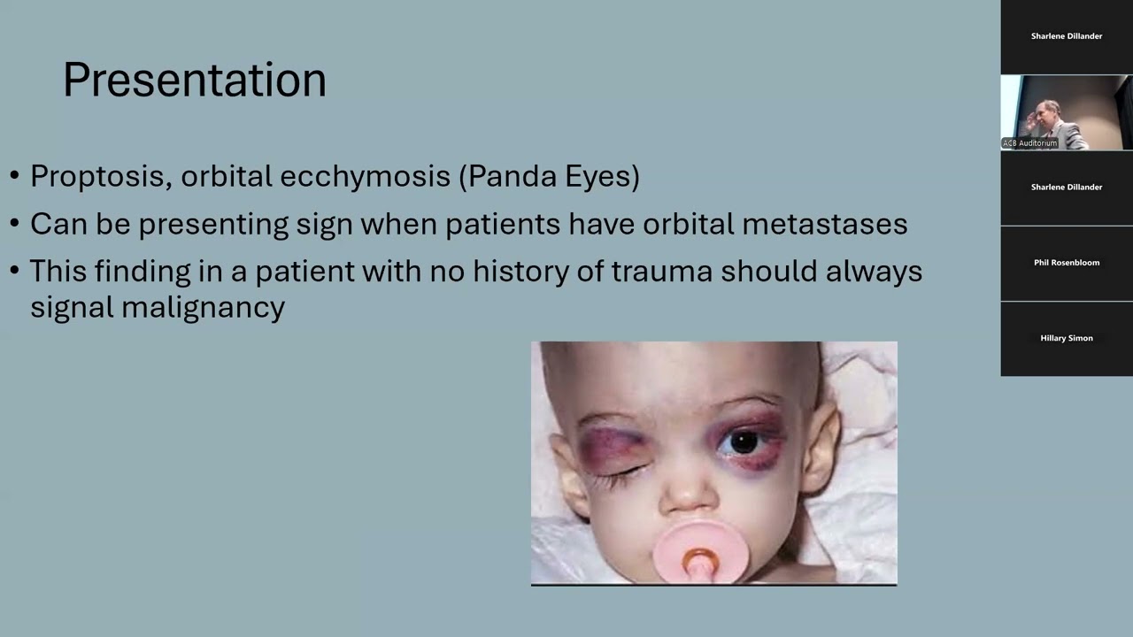 01.03.2025, &ldquo;Updates in Multidisciplinary Management of Neuroblastoma&rdquo;