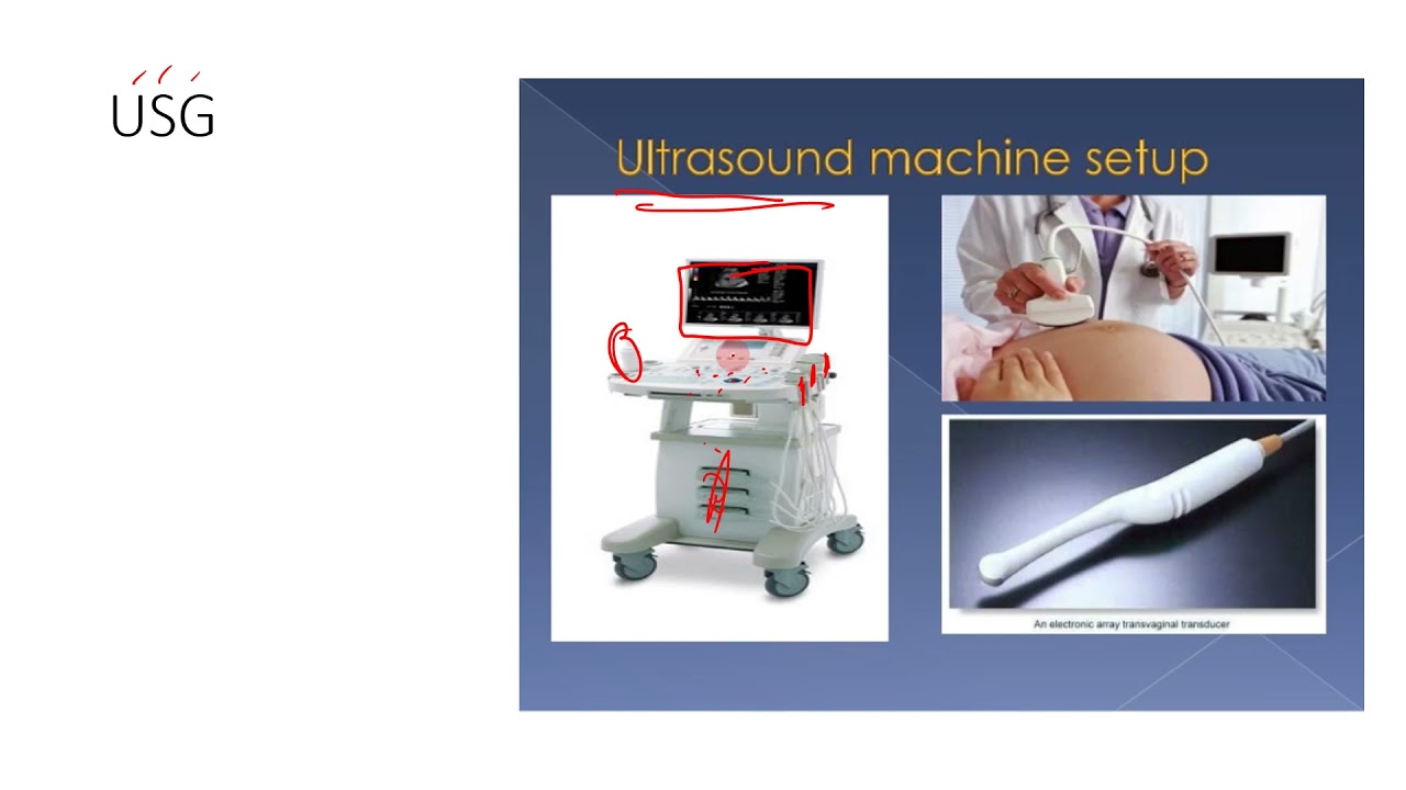 Video 12: Prenatal diagnosis (Embryology Lecture for MBBS students)