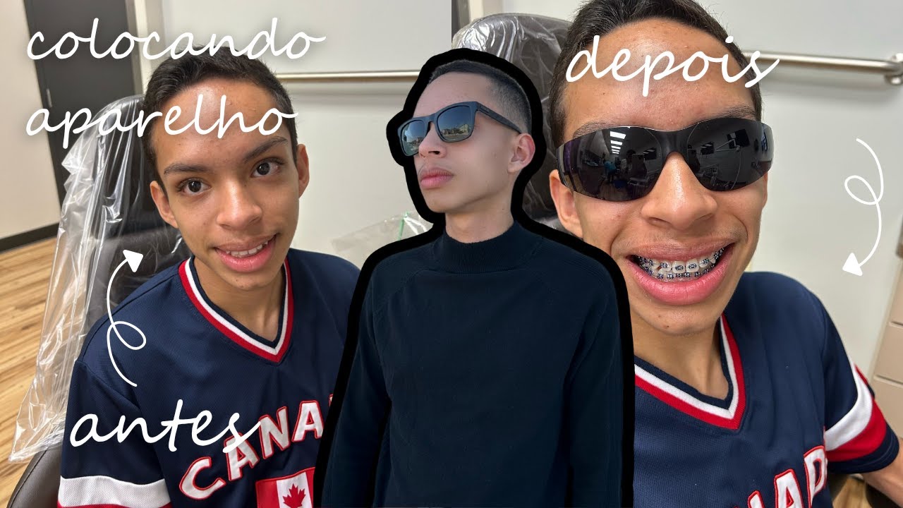 VLOG: Colocando Aparelho | Noann Brígido