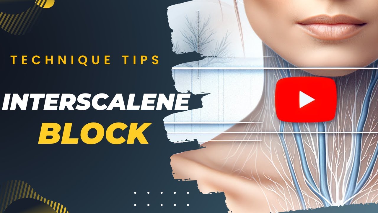 Pop above C5 to avoid interscalene block nerve damage