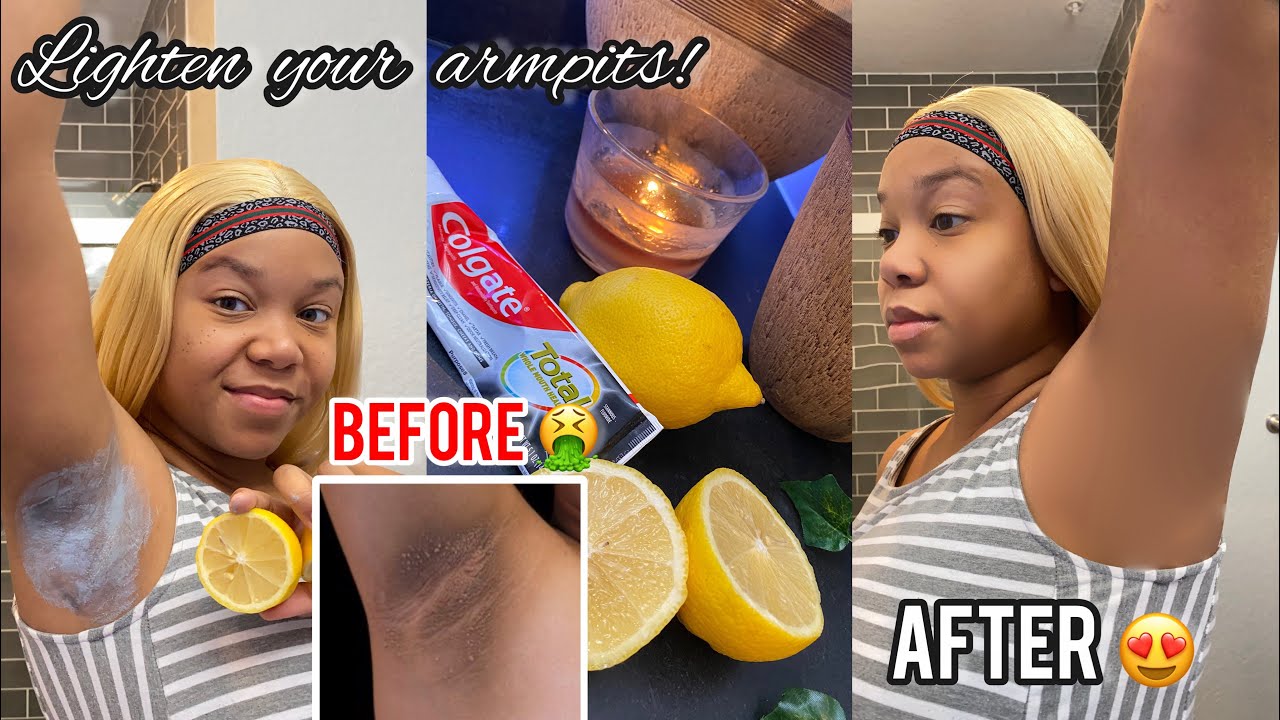 How to Lighten Your Underarms / Armpits Using Toothpaste and Lemons | Viral Beauty Hack