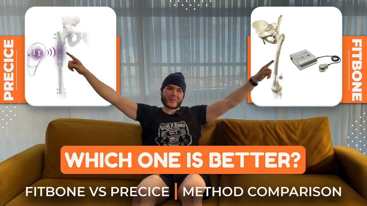 FITBONE ПРОТИВ PRECICE | СРАВНЕНИЕ МЕТОДОВ УДЛИНЕНИЯ КОНЕЧНОСТЕЙ