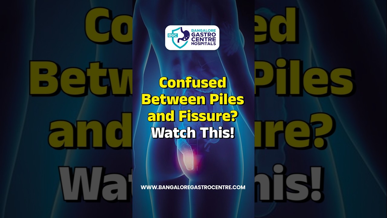 Confused Between Piles & Fissure? Know the Difference in 60 Seconds!