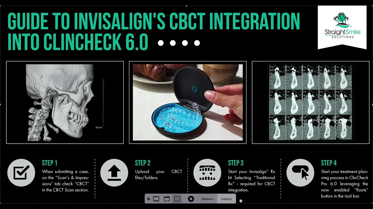 Guide to Invisalign CBCT Integration Into Clincheck 6.0