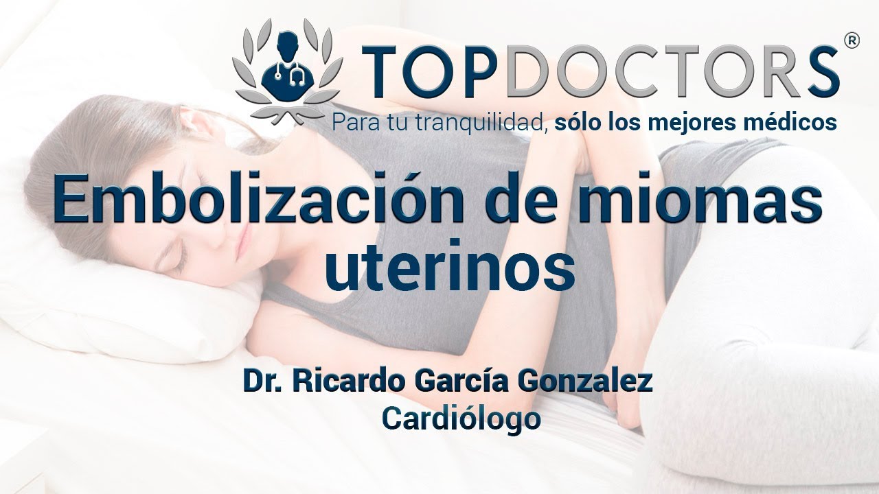 Embolización de miomas uterinos: conoce todos los detalles