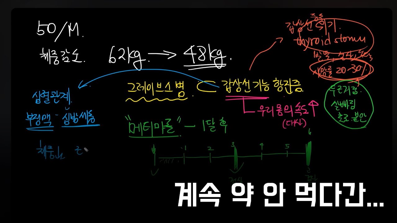 그레이브스병, 바쁘다고 약 안 먹으면 생기는 일