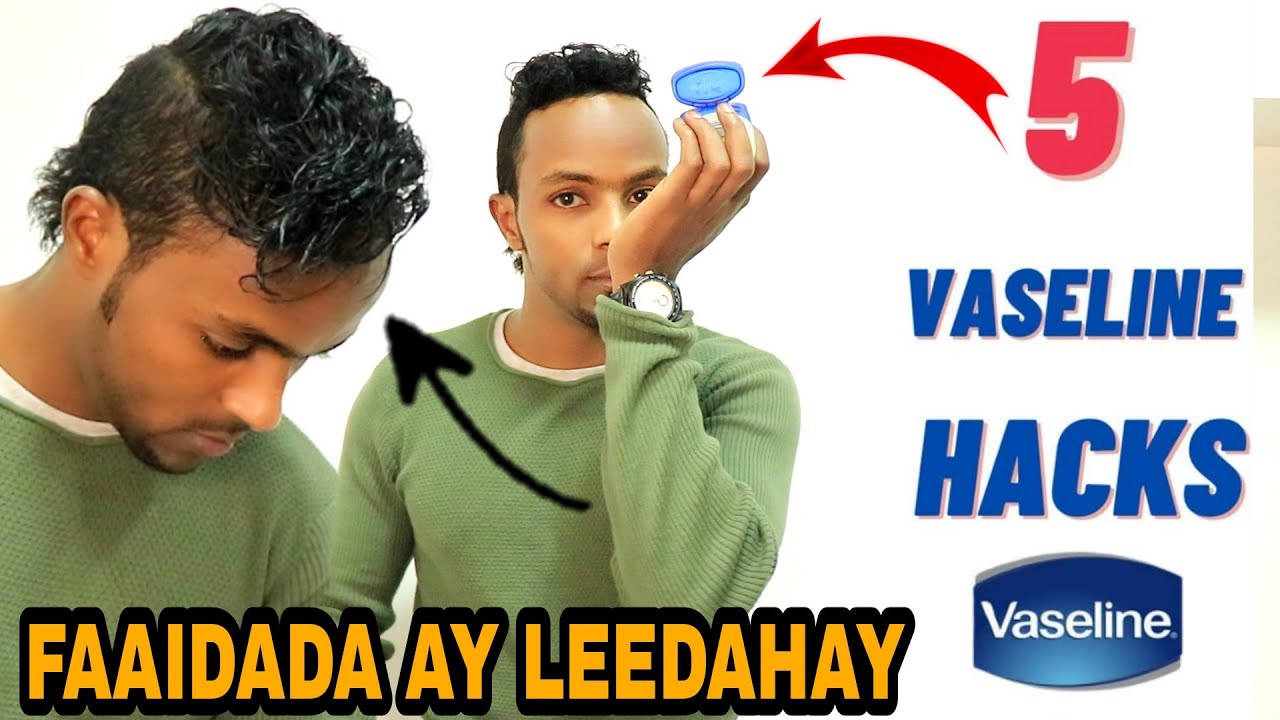 5 FAAIDO AY LEEDAHAY VASELINE KA OGOOW @bashkabashiir7791