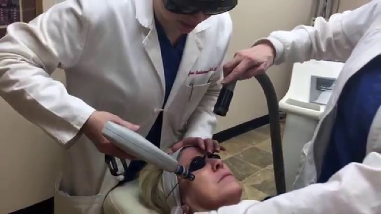 Pixel Laser Resurfacing Procedure