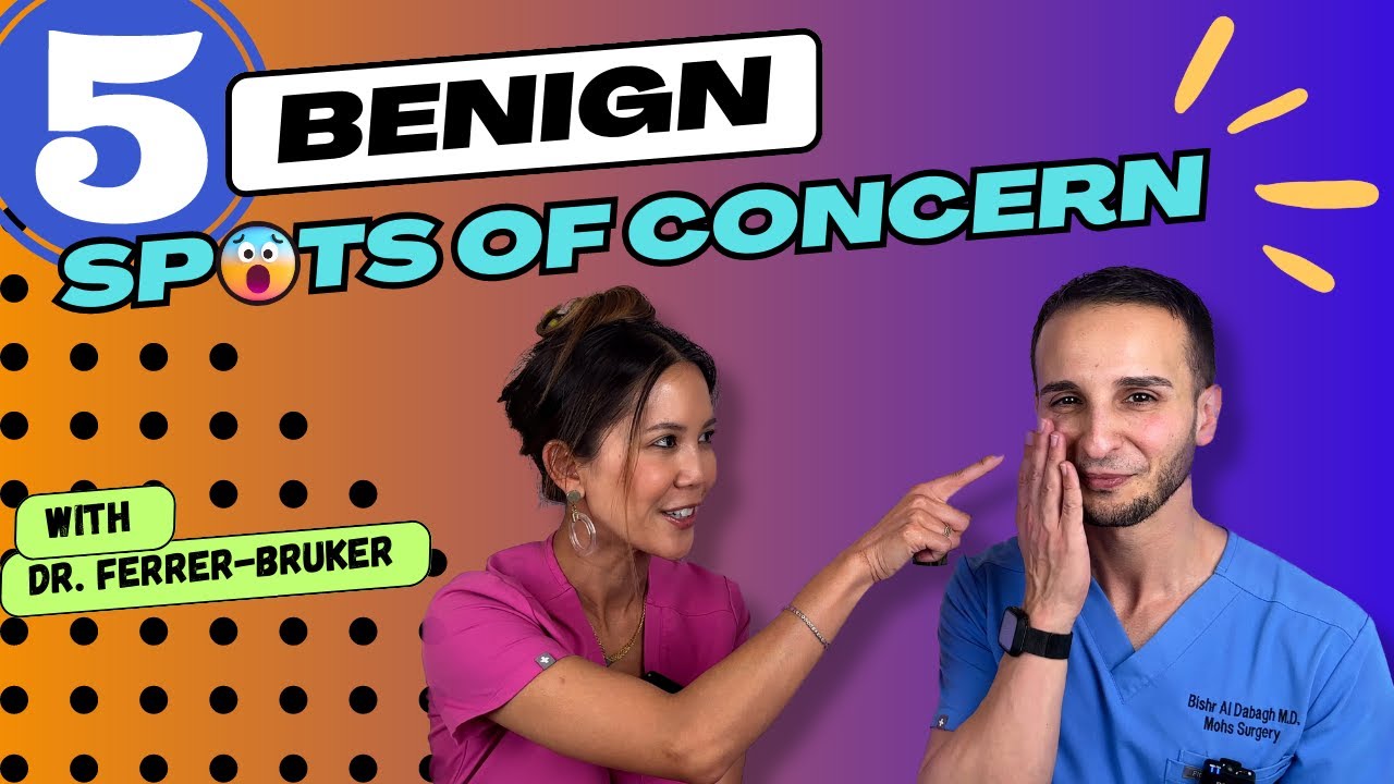 Most Common Benign Skin Lesions Patients See the Dermatologist For