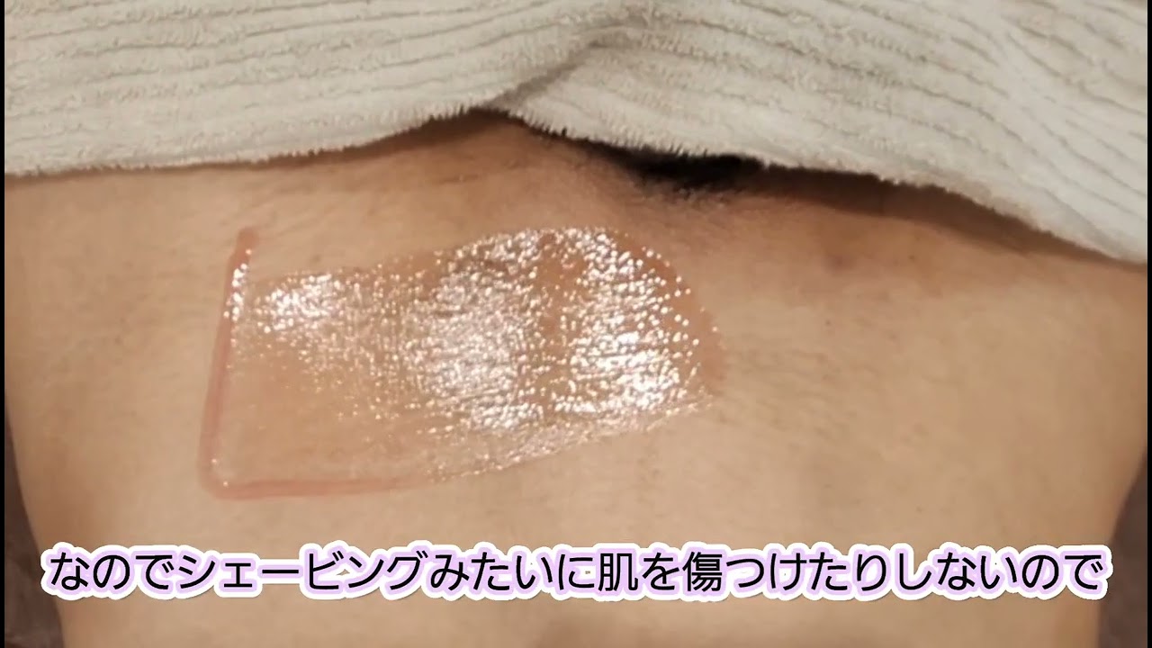 【施術動画】ワックスと光併用すると…