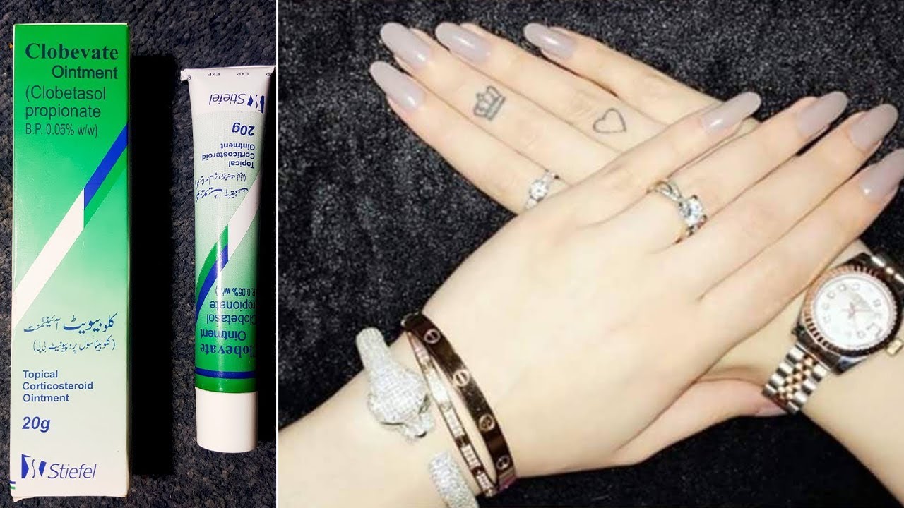 Clobevate Ointment Cream Review, Benefits, Uses, Price, Side Effects