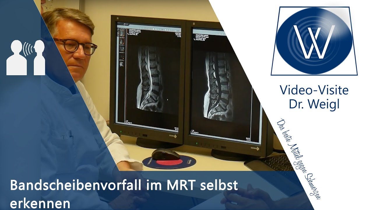 Eigenen Bandscheibenvorfall im MRT (Röhre) erkennen & Merkmale wissen - Hilfe bei d Selbstbefundung