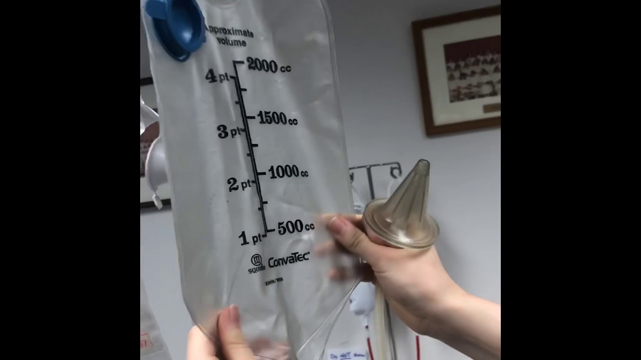 Ostomy Irrigation Bryce Yacos