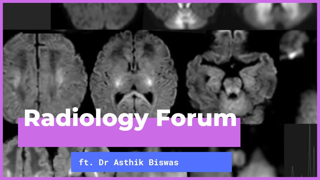 'Common Paediatric Neurometabolic Disorders - Early Imaging Recognition' by Dr Asthik Biswas