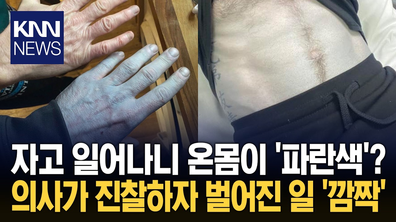 파란 피부에 극심한 피로감까지 건강 이상 의심했던 황당 사연 / KNN
