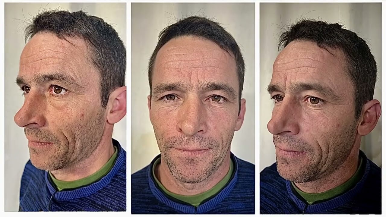 МОЕТО НОВО АЗ Епизод 2 Bellissimo Clinic - Историята на Иван