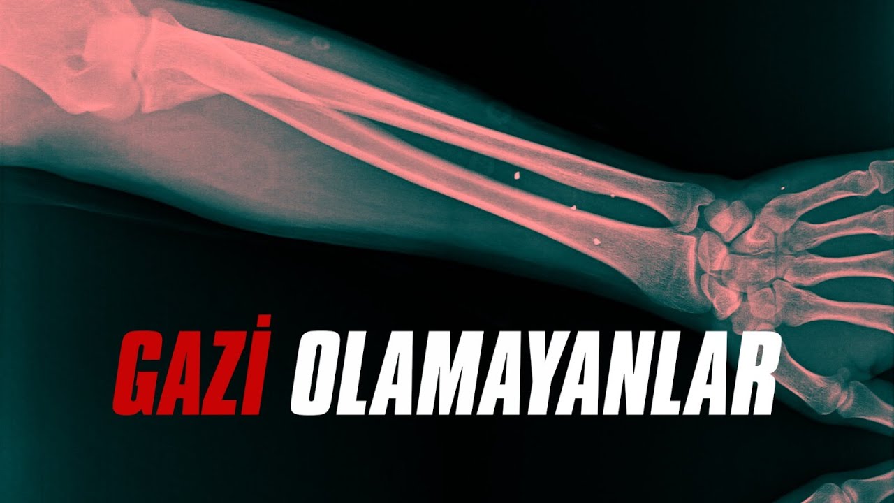 Gazi Olamayanlar: Hani Şehidin Şahidi Gaziydi | Belgesel