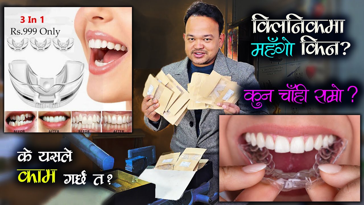 Online Vs Clinician's Clear Aligners // 3 in 1 Dental Care Kit ले दाँत मिलाउछ?// Clear Aligners