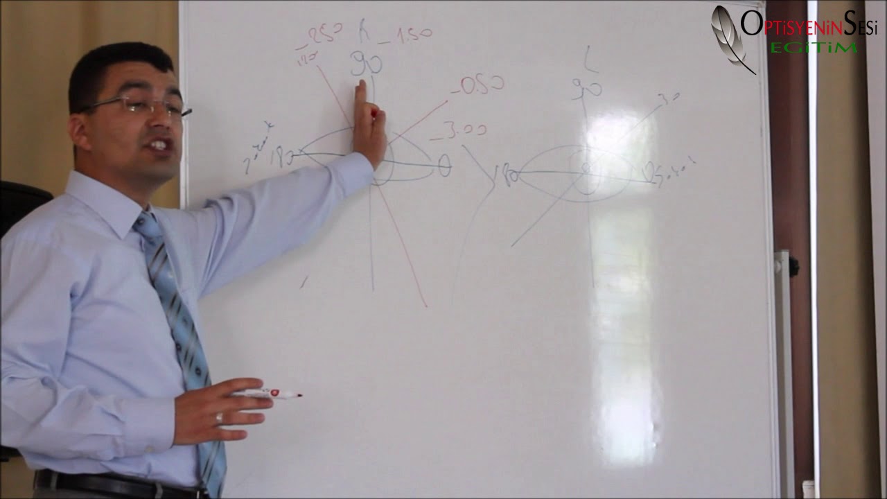 Refraksiyon Kusurlarının Düzeltilmesi ve Transpoze- 2