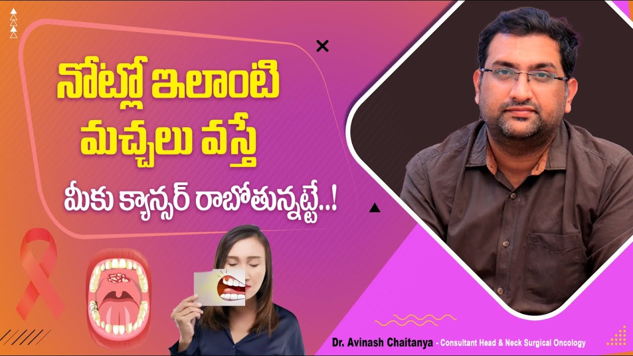 నోటి క్యాన్సర్ || Warning Signs of Oral Cancer || Oral Cancer Symptoms in Telugu || Kaizen Oncology