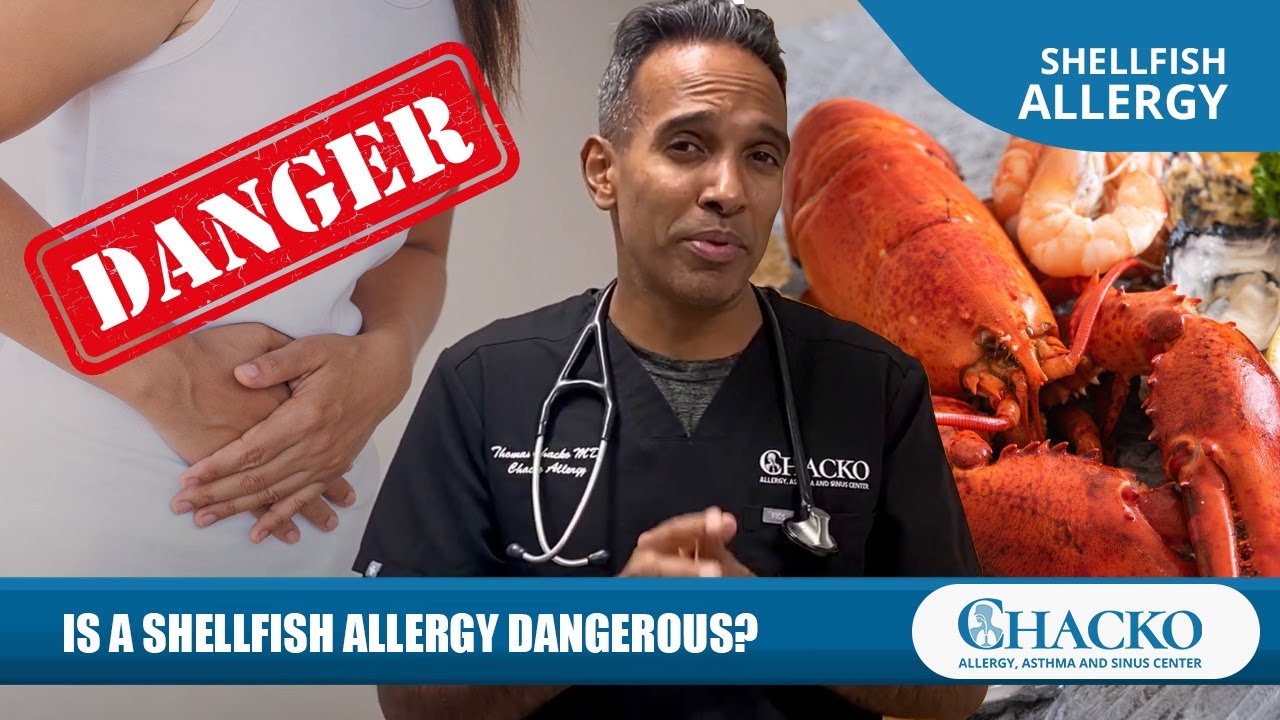 Is a Shellfish Allergy Dangerous? [Chacko Allergy]