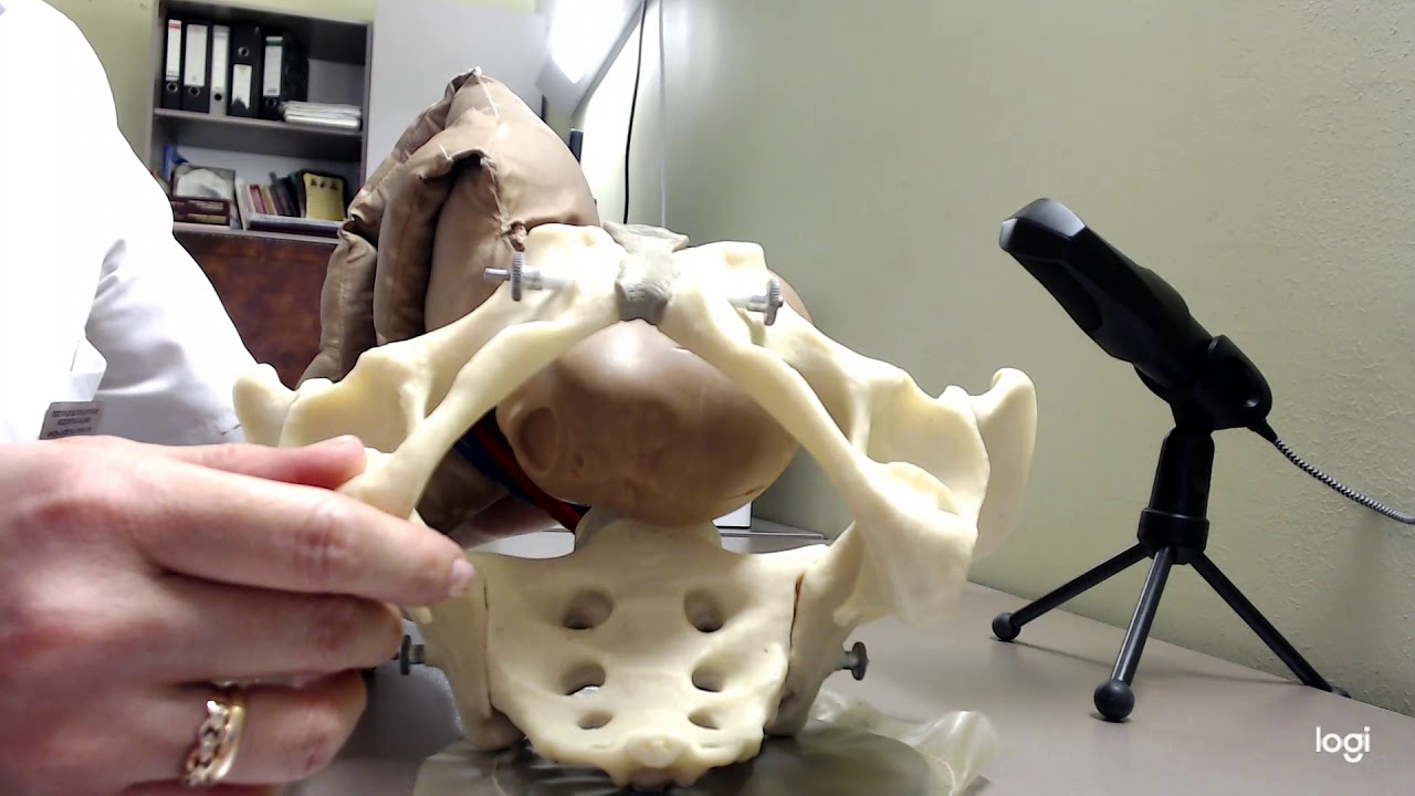 Биомеханизм родов при лицевом предлежании