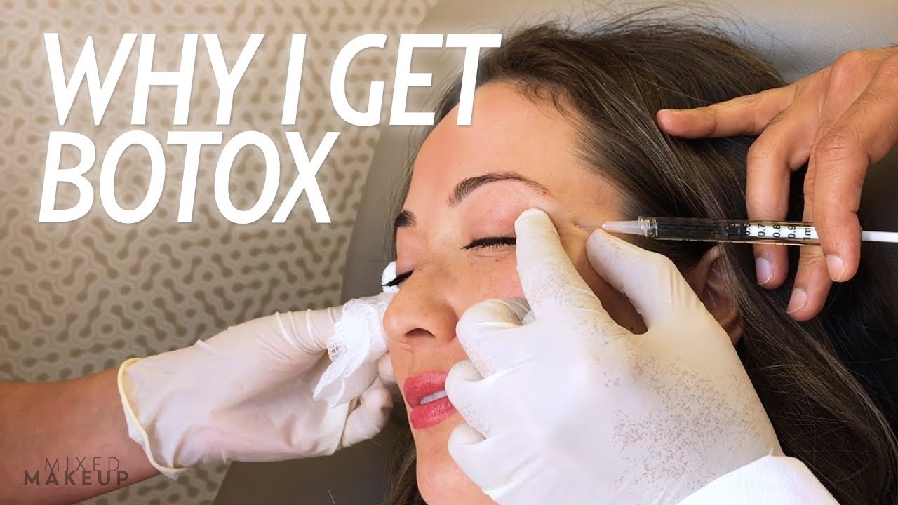 Why I Get Botox Injections for Wrinkles and More! | Beauty with Susan Yara