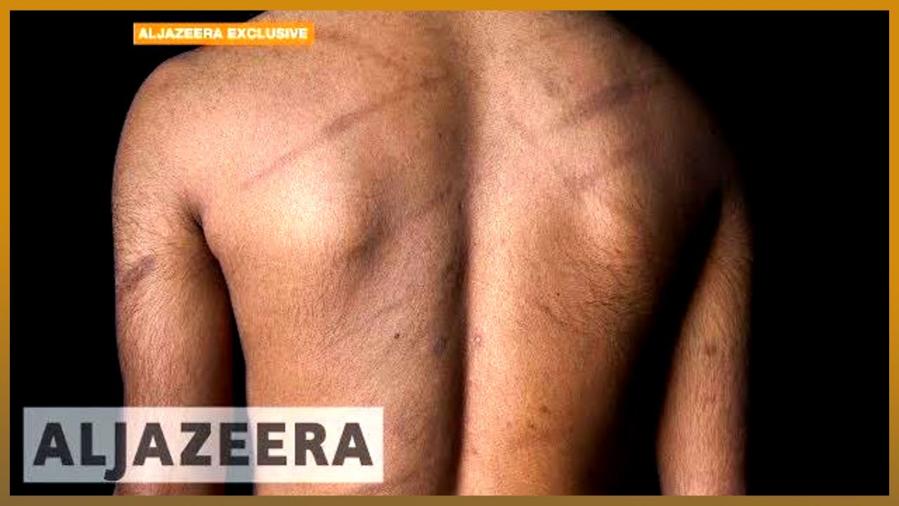 🇱🇰 Evidence of ongoing torture of Sri Lankan Tamils | Al Jazeera English