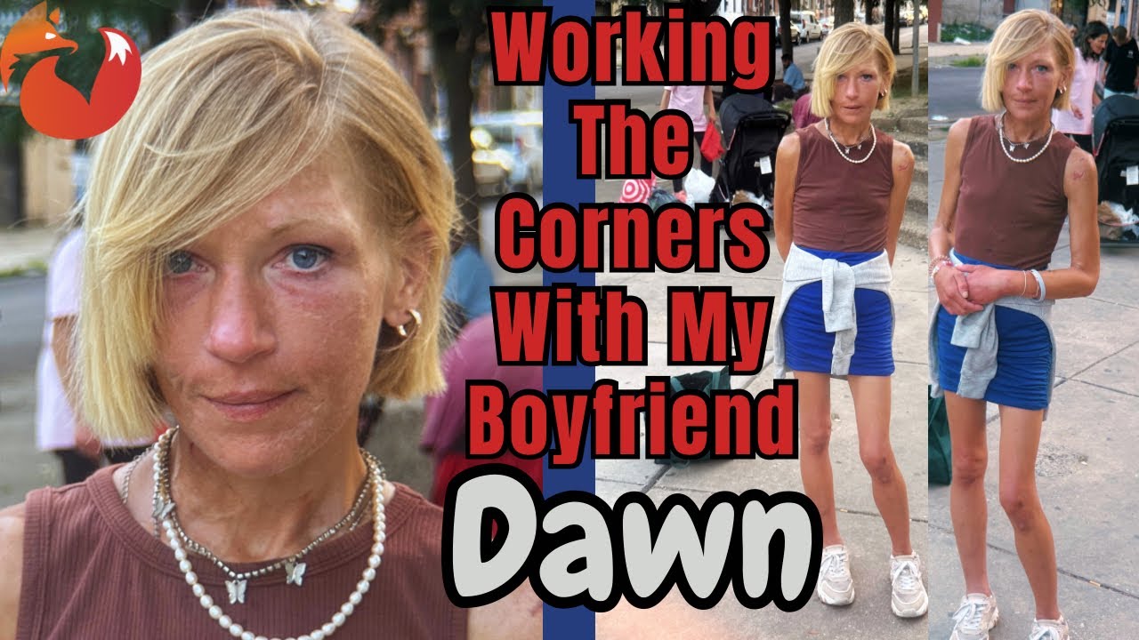 Dawn Update Interview - My Body Can’t Handle This Anymore